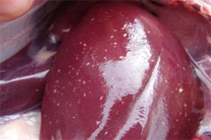 Ictericia y perdida de peso repentina